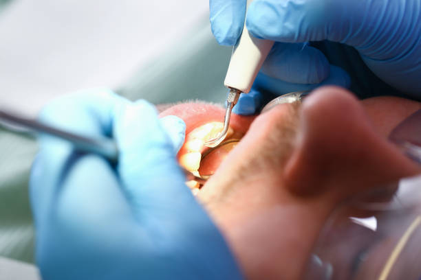 Best Emergency Dental Filling Replacement  in Gramercy, LA