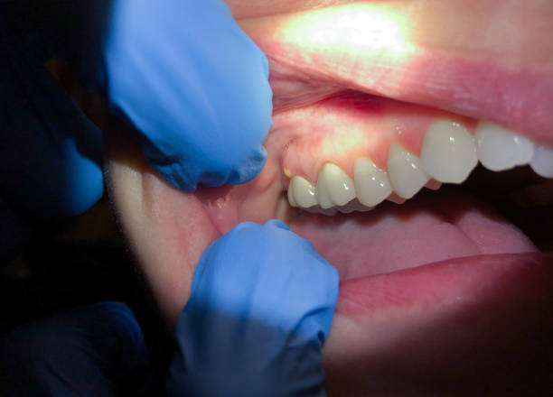 Best Emergency Gum Pain Relief  in Gramercy, LA