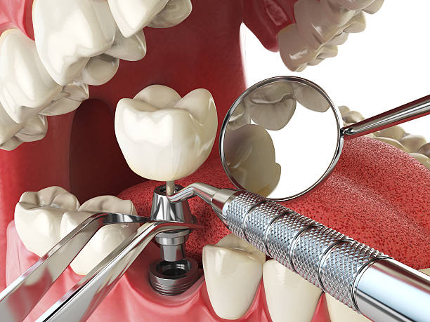 Best Tooth Infection Emergency Dentist  in Gramercy, LA